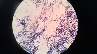 Bacillus species under the Microscope [upl. by Seko]