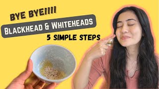 5 Hacks to get Rid of Blackheads in 1 day simple hacks homeremedies skincare [upl. by Niroc]