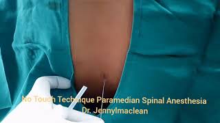 No Touch Technique Spinal Anesthesia by Paramedian Technique [upl. by Lladnyk]