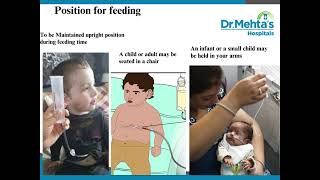 Button Gastrostomy Feeding [upl. by Enalda136]