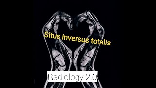 Case Report CT AbdomenSitus Inversus Totalis Situs SolitusSitus AmbiguusHeterotaxia syndrom [upl. by Rheinlander]