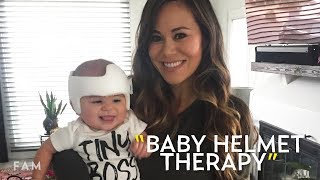 Baby Helmet Therapy for Plagiocephaly Brandi Milloys Experience [upl. by Yeclehc]