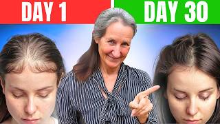 Barbara ONeills SHOCKING Hair Loss Discovery What They Hid From You [upl. by Debee]