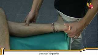 Fisioterapia UMH Dolor miofascial y puntos gatillo  Gastrocnemio medial [upl. by Archibold]