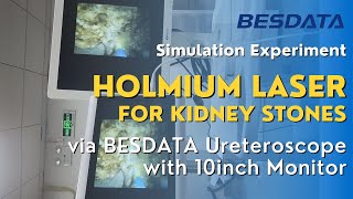 Simulation Experiment Holmium Laser for Kidney Stones via BESDATA Ureteroscope with 10inch Monitor [upl. by Inattirb]