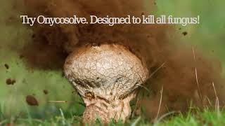 OnycoSolve  Designed To Kill All Fungus [upl. by Brunelle]