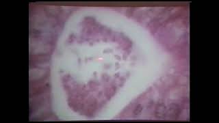 Identification of Protozoan Parasites in Tissue Section  Dr Gardiner 1993 [upl. by Anyaled]