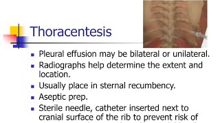 Thoracocentesis [upl. by Drandell]