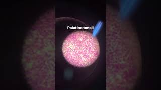 palatine tonsil [upl. by Htelimay]