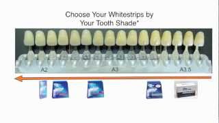 Crest 3D Whitestrips 2 Years Later How to Whiten Teeth EASY [upl. by Ecinad]