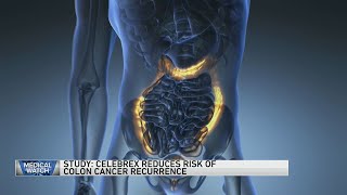 Study Celebrex reduces risk of colon cancer recurrence — and more [upl. by Fleming]