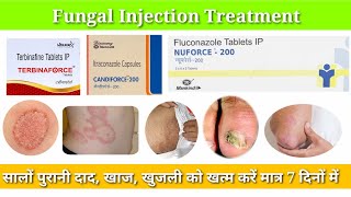 Fungal Infection Treatment  Top 3 Antifungal Medicines  Fungal Infection medicine pharmacy [upl. by Lelith]