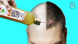 5 MAGICAL BENEFITS OF APPLE CIDER VINEGAR FOR HAIR amp SKIN [upl. by Palecek207]