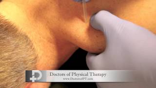 Trigger Point Dry Needling Local Twitch Response [upl. by Weinstock]