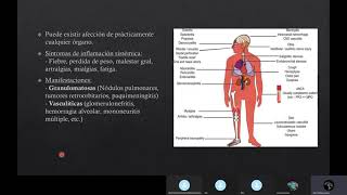 Granulomatosis con Poliangeitis [upl. by Bridges]