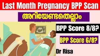 9 month Pregnancy ScanLast Month Pregnancy ScanWhat is BPP score [upl. by Elwee]