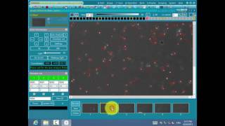 BUM400A Automated digital biological microscope sperm analysis [upl. by Bridwell531]