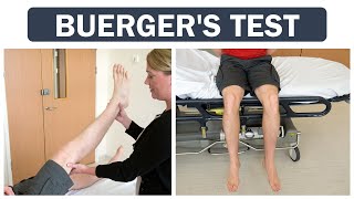 Buergers Test [upl. by Etnovert572]