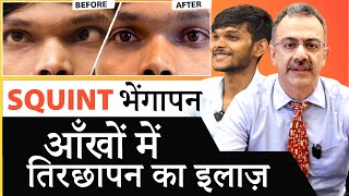 SQUINT  STRABISMUS TREATMENT  आँखों के भैंगापन  तिरछेपन का इलाज [upl. by Enelyk]