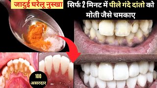 ORAL HYGIENE TIPS URDU  Danto Ki Safai Kaise Karte Hain  Teeth Cleaning At Home  Dental Flossing [upl. by Hiltan]