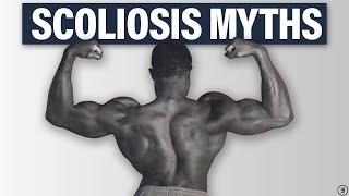 5 Facts You NEED to Know About Scoliosis Best Exercises Back Pain Performance and More [upl. by Ecinaej]