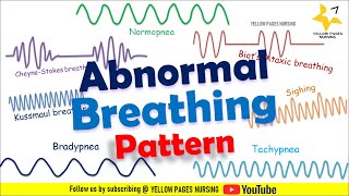 ABNORMAL BREATHING PATTERN  Apnea  Bradypnea  Tachypnea  Ataxic  Sighing  CheyneStokes [upl. by Sirovaj]