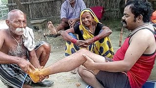 पैर की मोच का घरेलू इलाजpair ki moch पैर की मोच कैसे ठीक करें Ankle sprain treatment in Hindi नयन [upl. by Longley395]