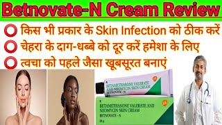 BetnovateN। BetnovateN Skin cream review 2023। How to uses betnovate n skin cream on face। [upl. by Onimixam]