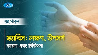 স্ক্যাবিস  লক্ষণ উপসর্গ কারণ এবং চিকিৎসা  Sustho Thakun  Rtv Health Program [upl. by Hoffert]