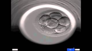 Entwicklung eines menschlichen Embryos [upl. by Eaner]