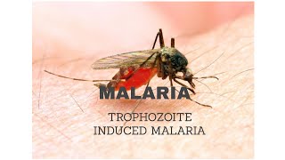 11MALARIA Trophozoite induced malaria [upl. by Naashom146]