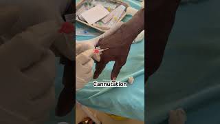 Cannulation nurses cannula mbbs doctor neet neetstudents nursingstuden mbbsstudnets shorts [upl. by Luht]