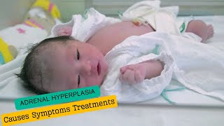 Classic Congenital Adrenal Hyperplasia Causes Symptoms Treatments [upl. by Ramsa]