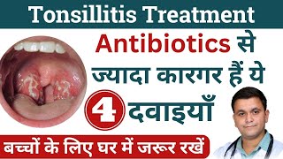 Tonsils Homeopathic medicine Tonsillitis Homeopathic Treatment Best homeopathic medicine for tonsils [upl. by Ragland]