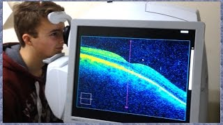 What is OCT Scanning Optical Coherence Tomography [upl. by Sitoiyanap399]