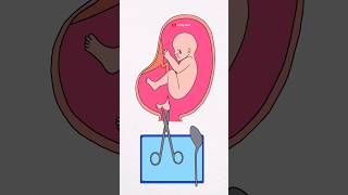 Dont be cruel to your baby 🥺😭 artbylaba shorts shortsfeed deepmeaning animationvideo [upl. by Etterb]