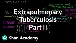 Extrapulmonary TB Part 2  Infectious diseases  NCLEXRN  Khan Academy [upl. by Pratt]