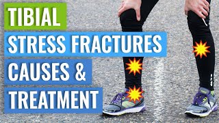 Tibial Stress Fractures  Treatment amp Healing Times [upl. by Imhsar]