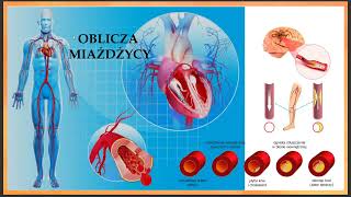 07 ZDROWIE METABOLICZNE  Okiem Praktyka i Dietetyka 20240814 zaburzenia krążenia [upl. by Salazar81]