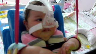 Spinal Muscular Atrophy Type 1 Amanda 13 months old [upl. by Dronski]