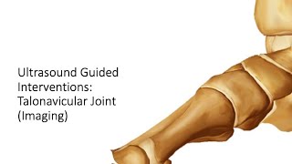 ultrasound Guided Interventions Talonavicular Joint Imaging fyp sport sports sportsmedicine [upl. by Eizeerb]