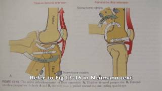 OT 440 Kinesiology Lower extremity knee locking mechanism [upl. by Muhan546]