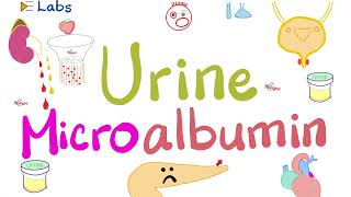 Microalbumin in the Urine Microalbuminuria  Diabetes Mellitus amp Kidney Disease  Nephrology Labs [upl. by Gerik800]