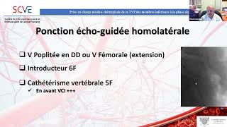 Prise en charge médicochirurgicale de la thrombose veineuse profonde des membres inférieur [upl. by Manlove801]