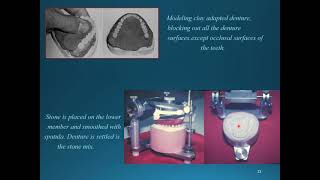 MISCELLANEOUS CLINICAL amp LABORATORY PROCEDURES Relining Rebasing and Repair of Complete Denture [upl. by Enialedam]