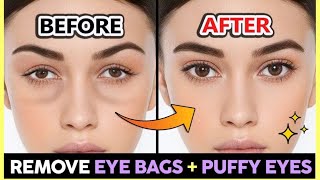 How to reduce puffy eyes exercisesFace yoga exercise to reduce puffy eyes [upl. by Aillemac268]