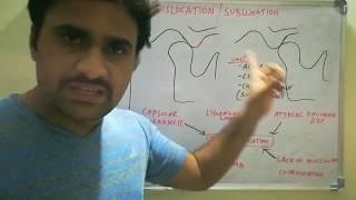 Dislocation of TMJ  Manual reduction [upl. by Eire625]