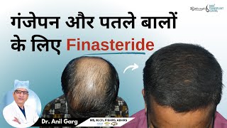 गंजेपन और पतले बालों के लिए Finasteride  FINASTERIDE क्या होता है  Right Dose Of Finasteride [upl. by Ecargyram]