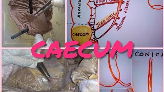 Anatomy of CAECUM [upl. by Nealon]