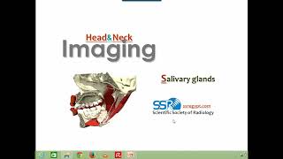 Imaging of Salivary glands DRE Prof Mamdouh Mahfouz [upl. by Cynthie]